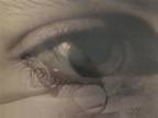 Rond a Nouveau : Yeux